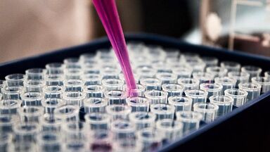 Wie man Tests zum Erkennen von Parasiten im Körper durchnimmt